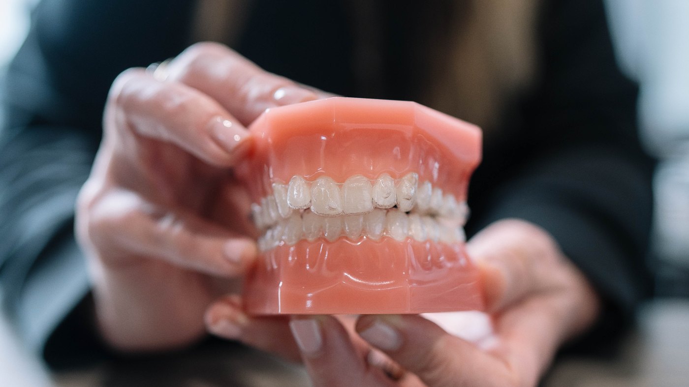 Clear Invisalign aligners on a dental model held in hand at Rogers & Andrews Orthodontics